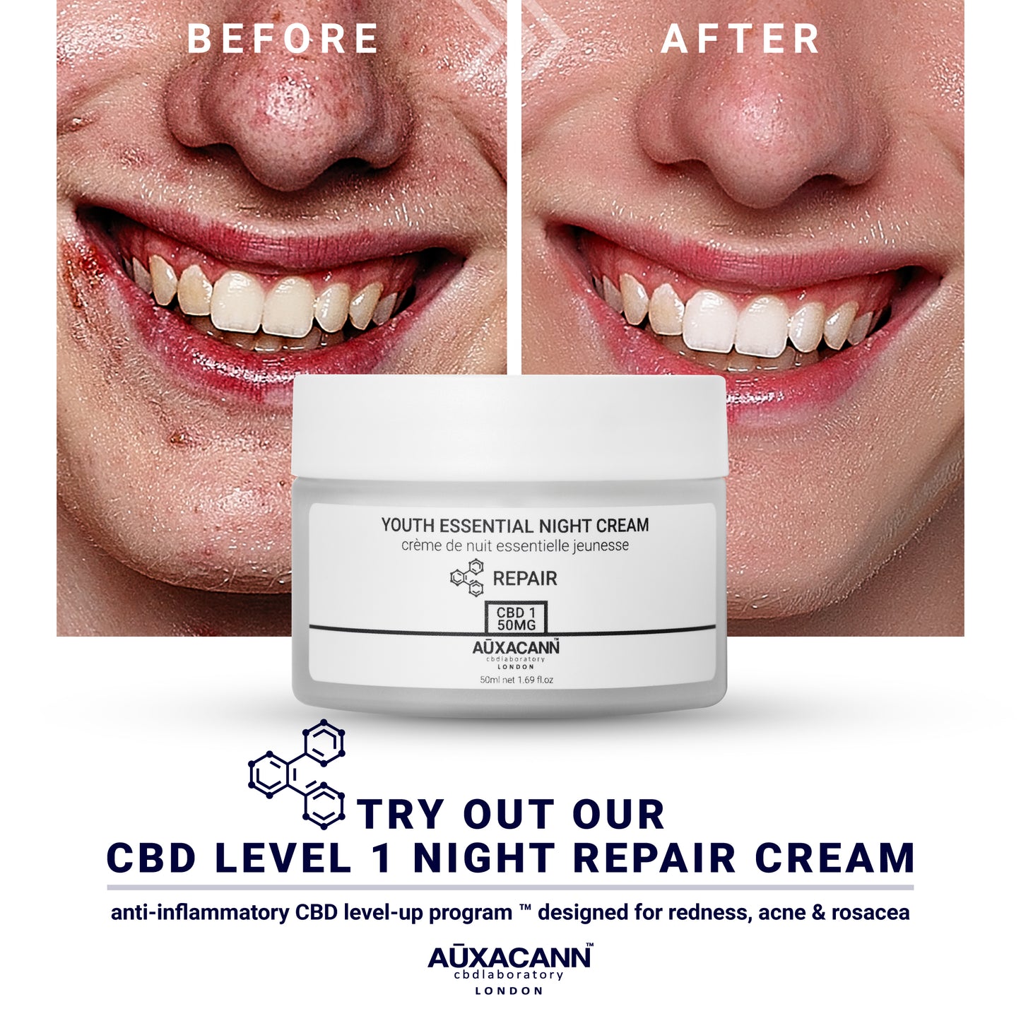 3 MONTH CBD LEVEL-UP PROGRAM™