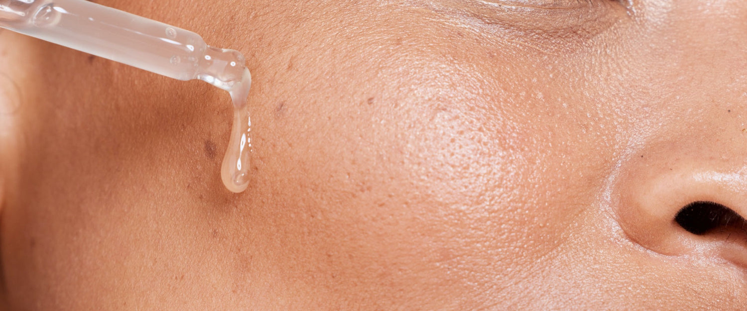 What’s the best serum for pigmentation, and what causes it?