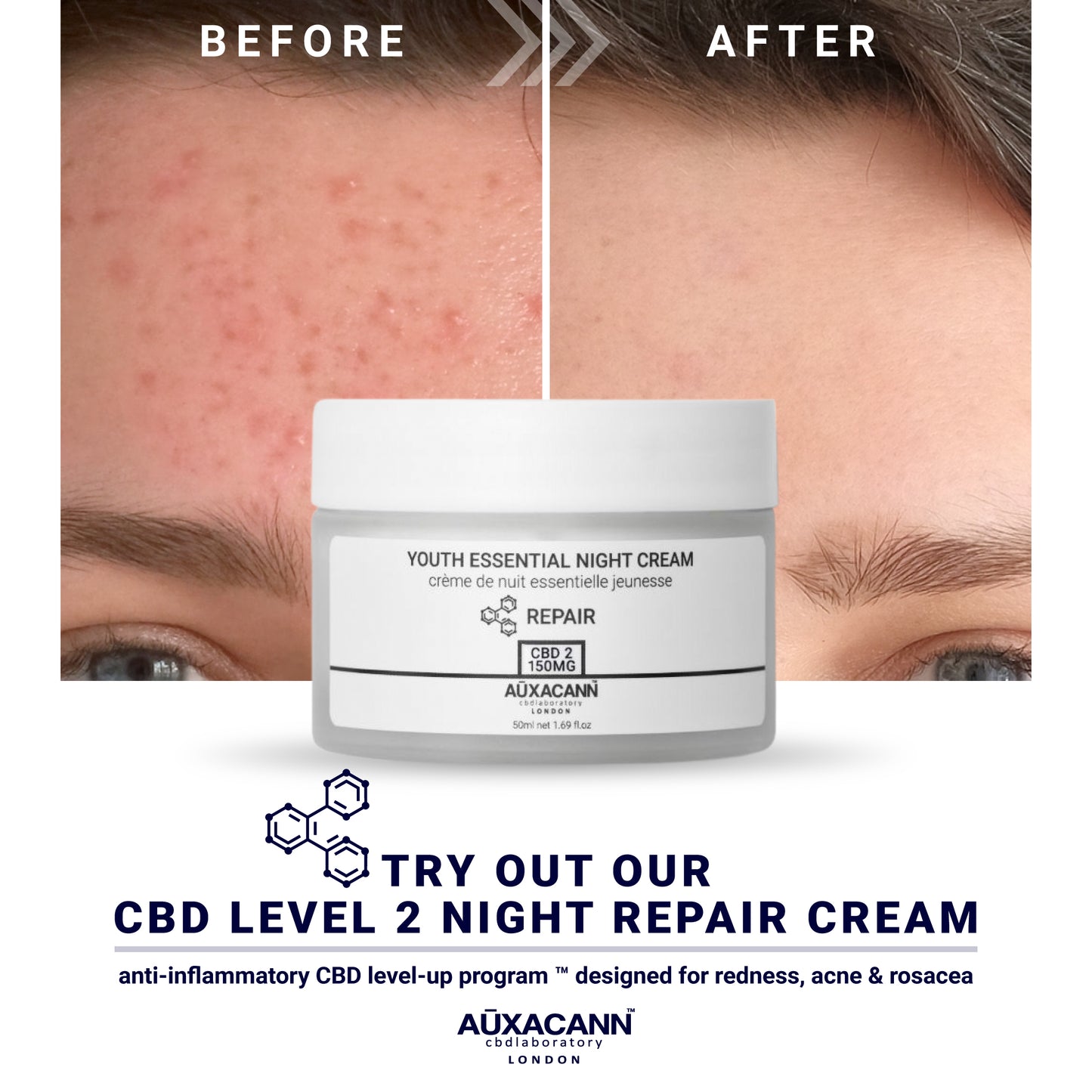 3 MONTH CBD LEVEL-UP PROGRAM™