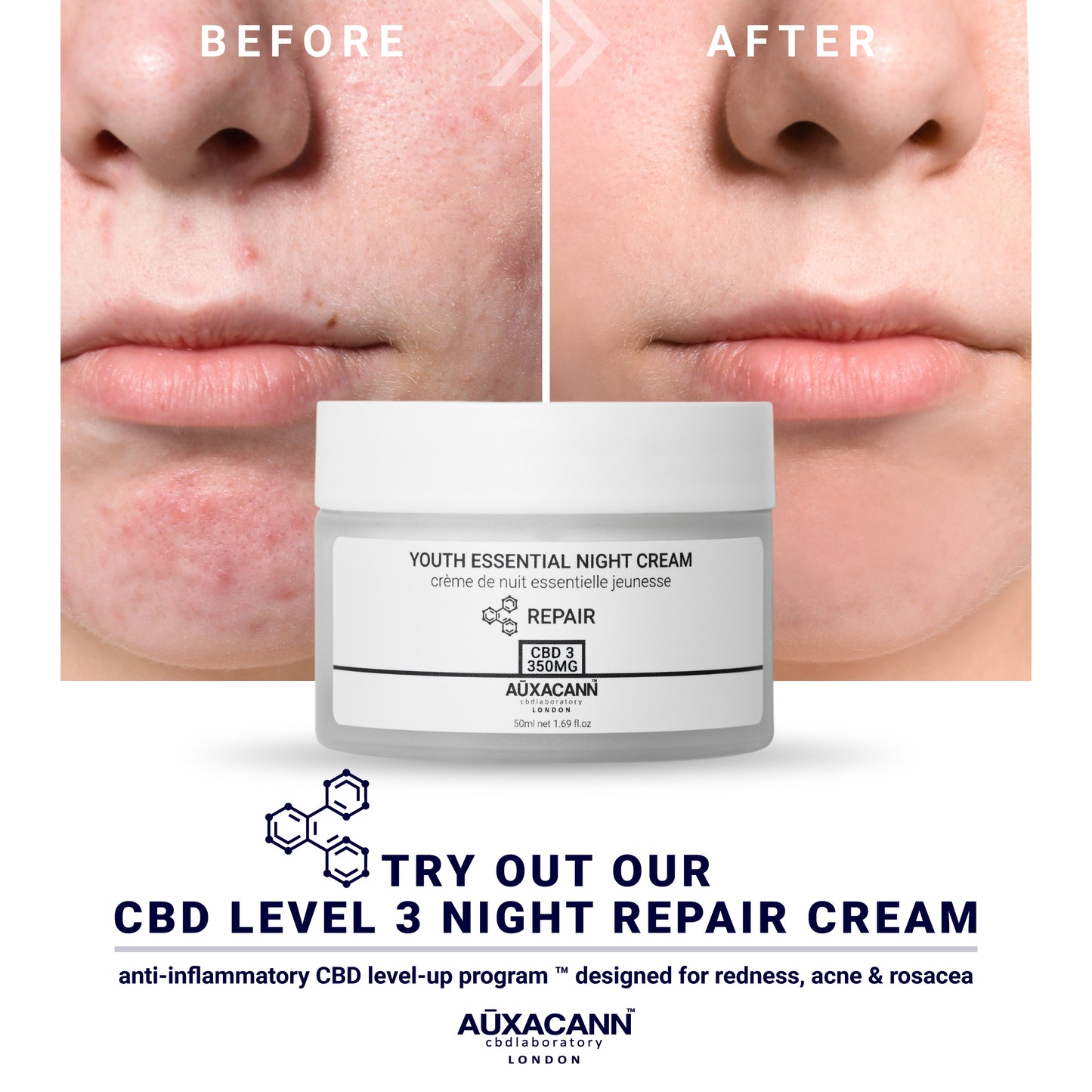 3 MONTH CBD LEVEL-UP PROGRAM™