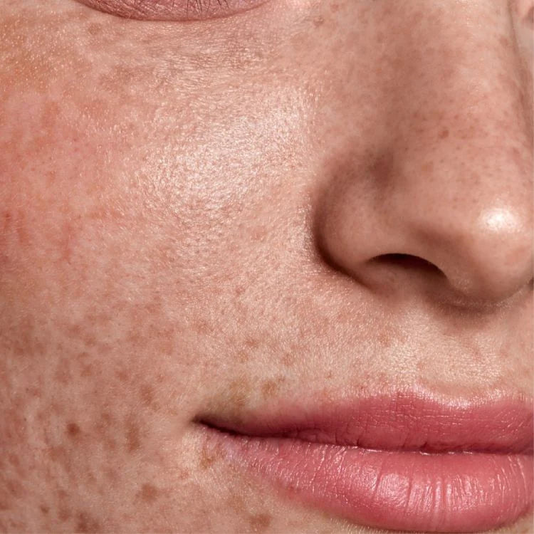 CBD BLEMISH GLYCOLIC ACID CONTROL PADS